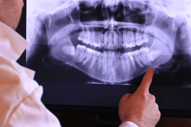 Best Weekend Emergency Dentist in Richmond Heights, OH